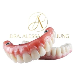 Implantes Dentários