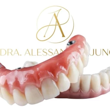 Imagem Implantes Dentários